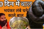 fastest-hair-growth-remedies